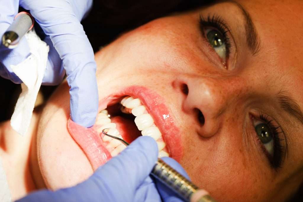 Teeth Cleaning and Hygiene